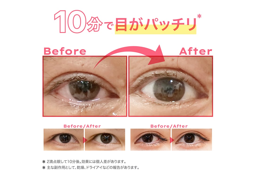 点眼して10分待つだけ☺️