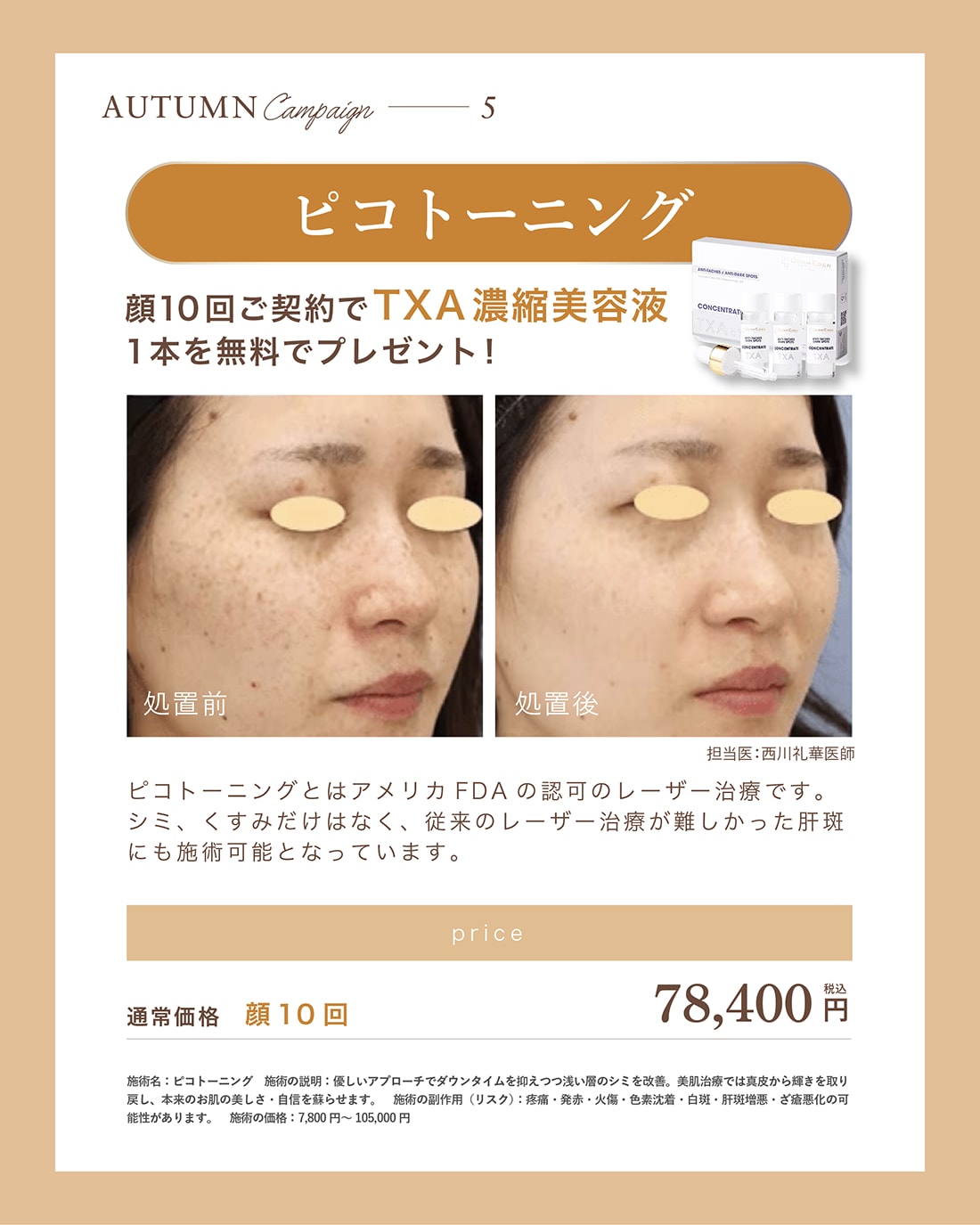 ピコトーニング