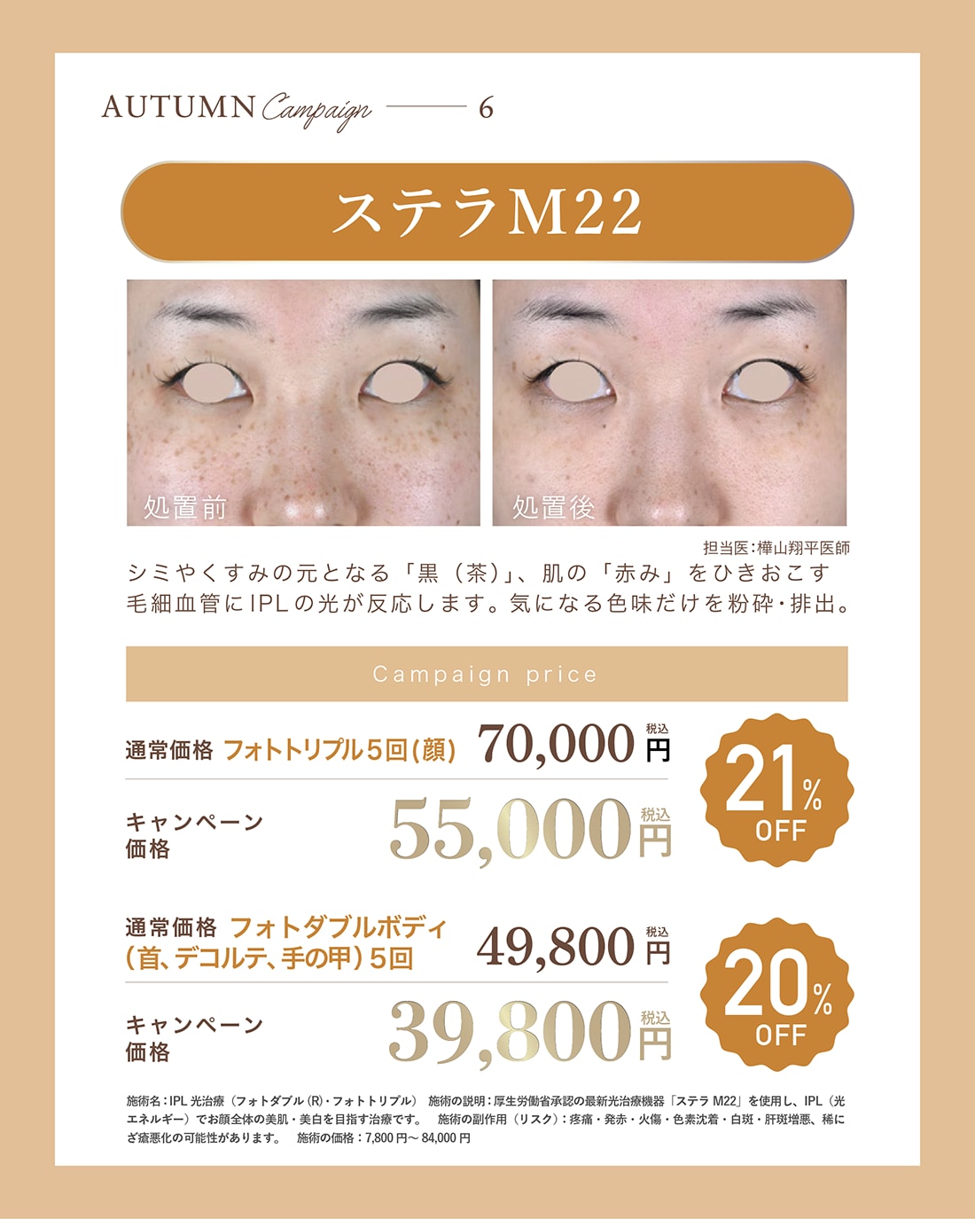 ステラM22