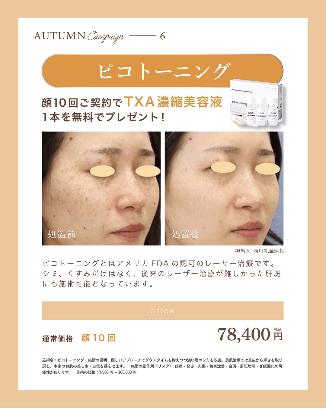 ピコトーニング