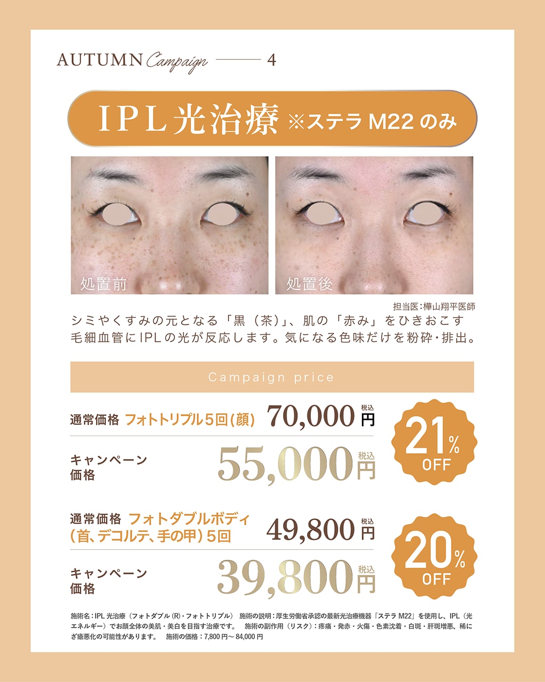 ステラM22