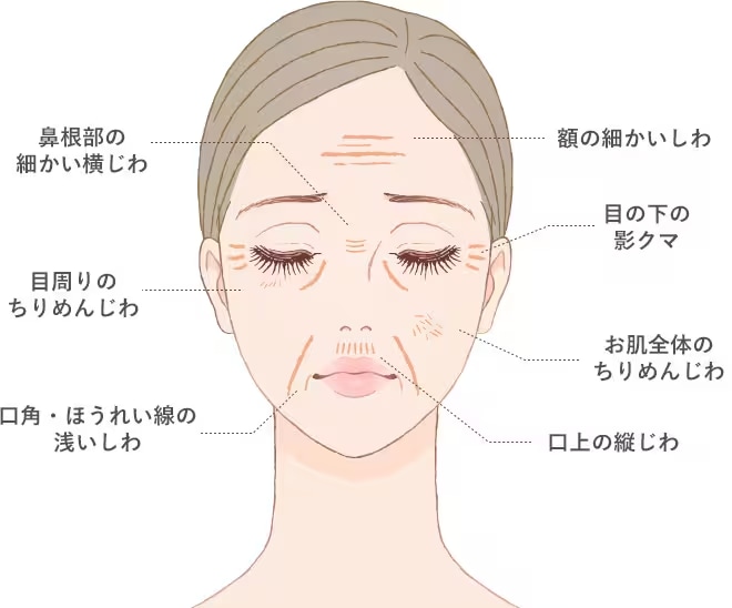 皮膚の薄い部分にも注入OK