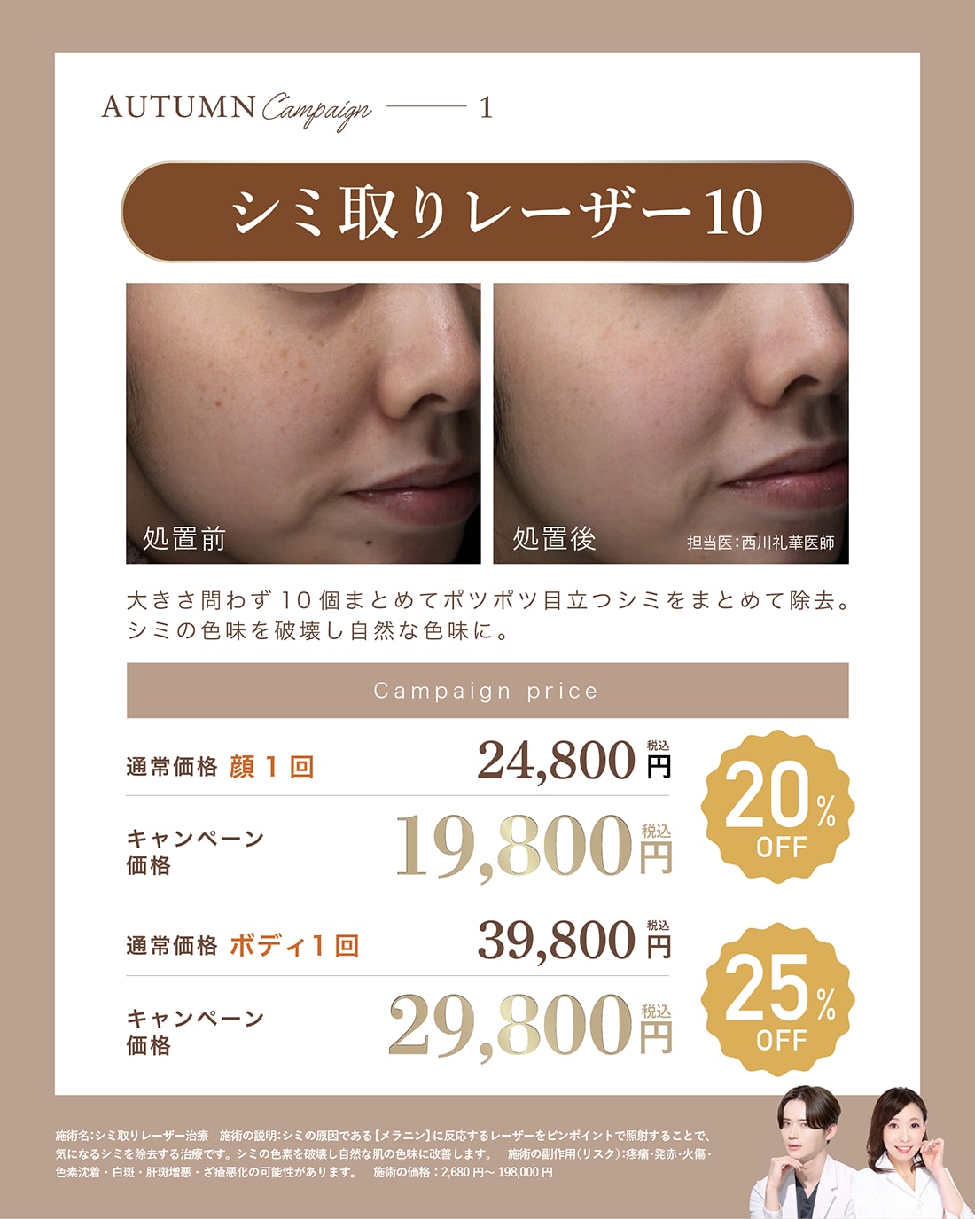 シミ取りレーザー（顔・ボディ対応）
