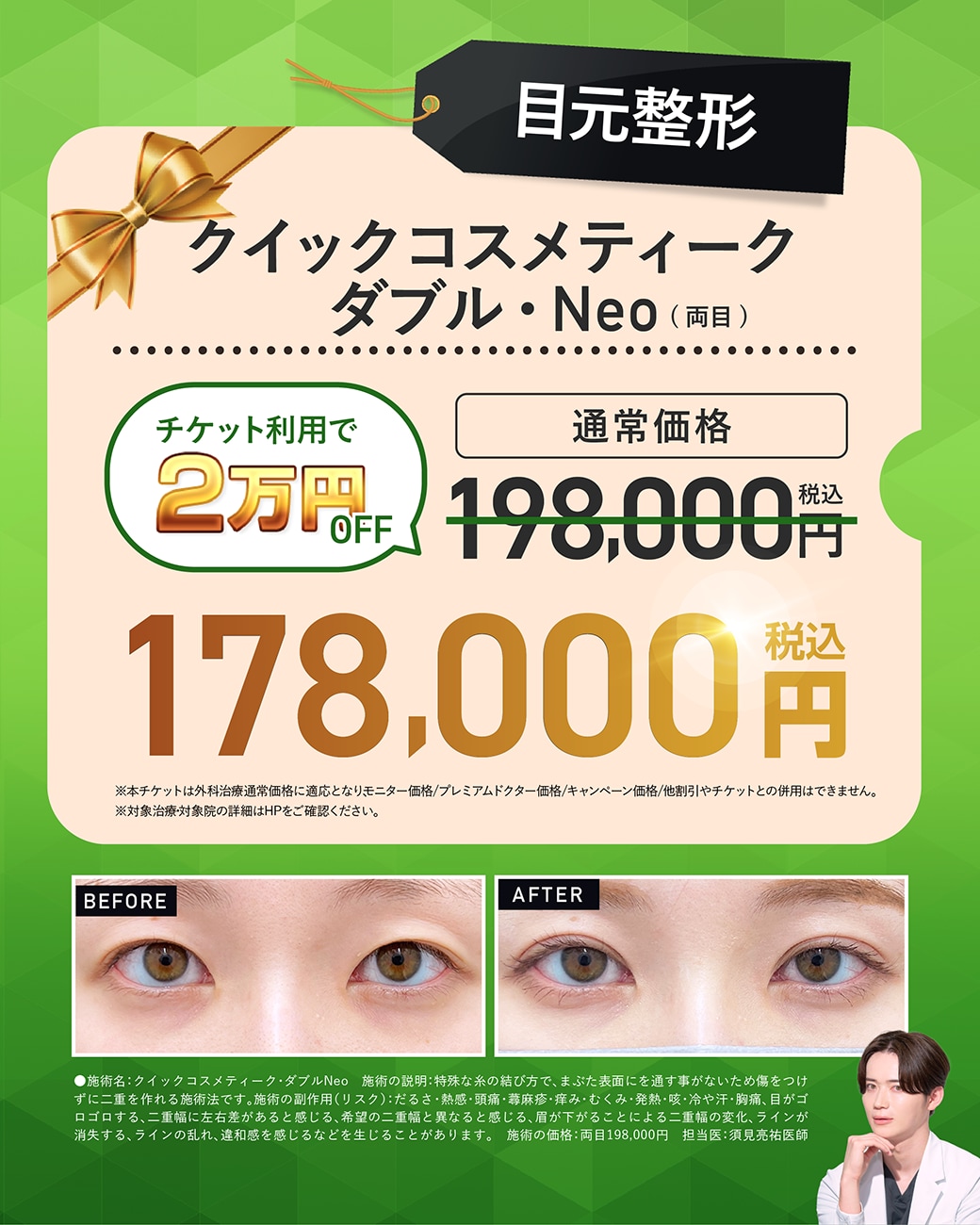 クイックコスメティークNeo・ダブル（二重埋没）