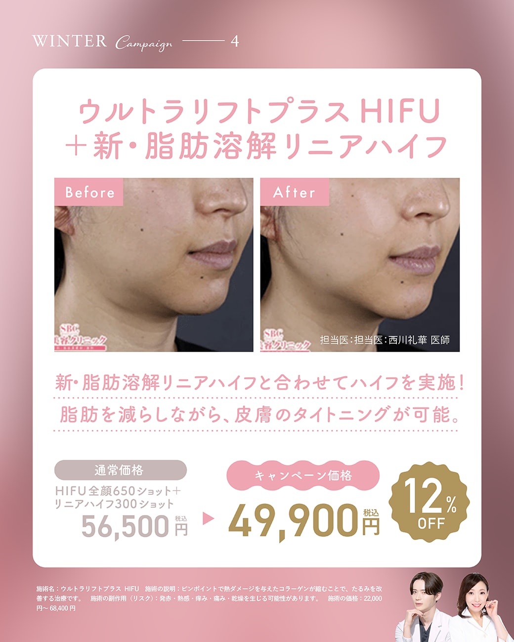 【取り扱い施術④】ウルトラリフトプラスHIFU＋新・脂肪溶解リニアハイフ