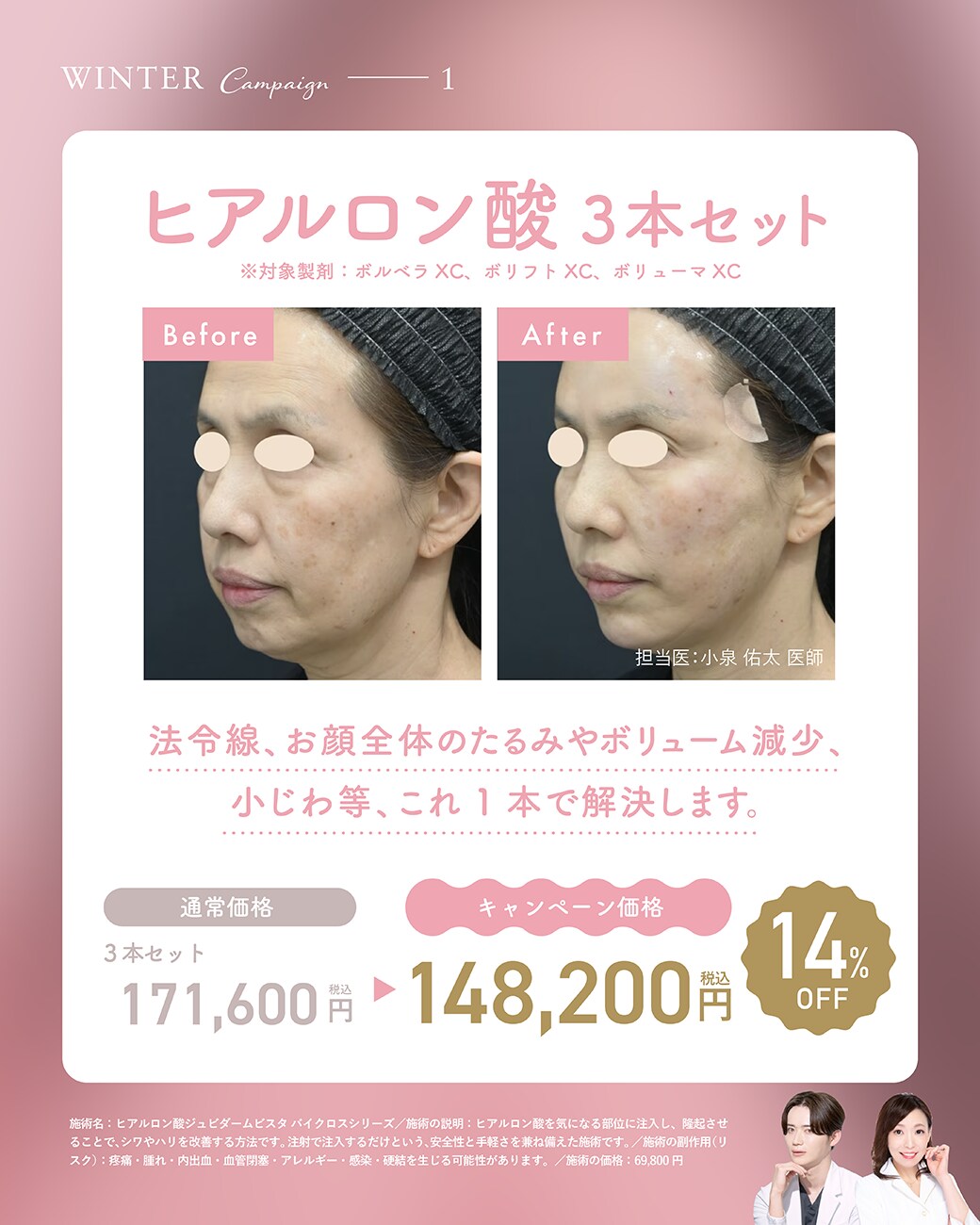 【取り扱い施術①】ヒアルロン酸注入