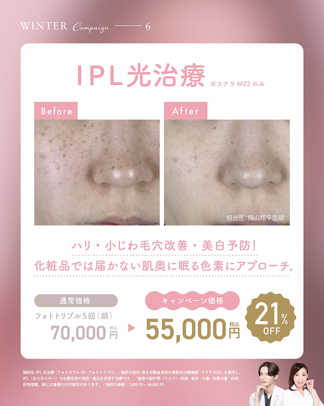 【取り扱い施術⑥】IPL光治療 ※ステラM22のみ