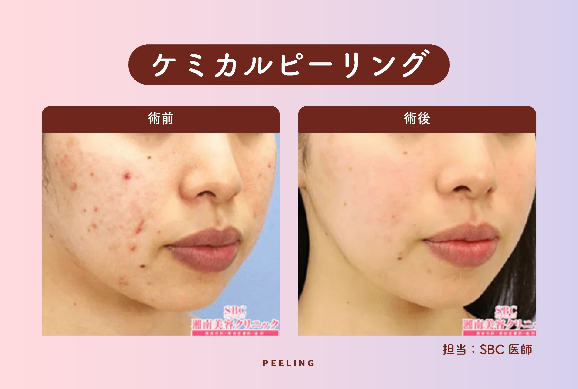 ごわつきをリセット