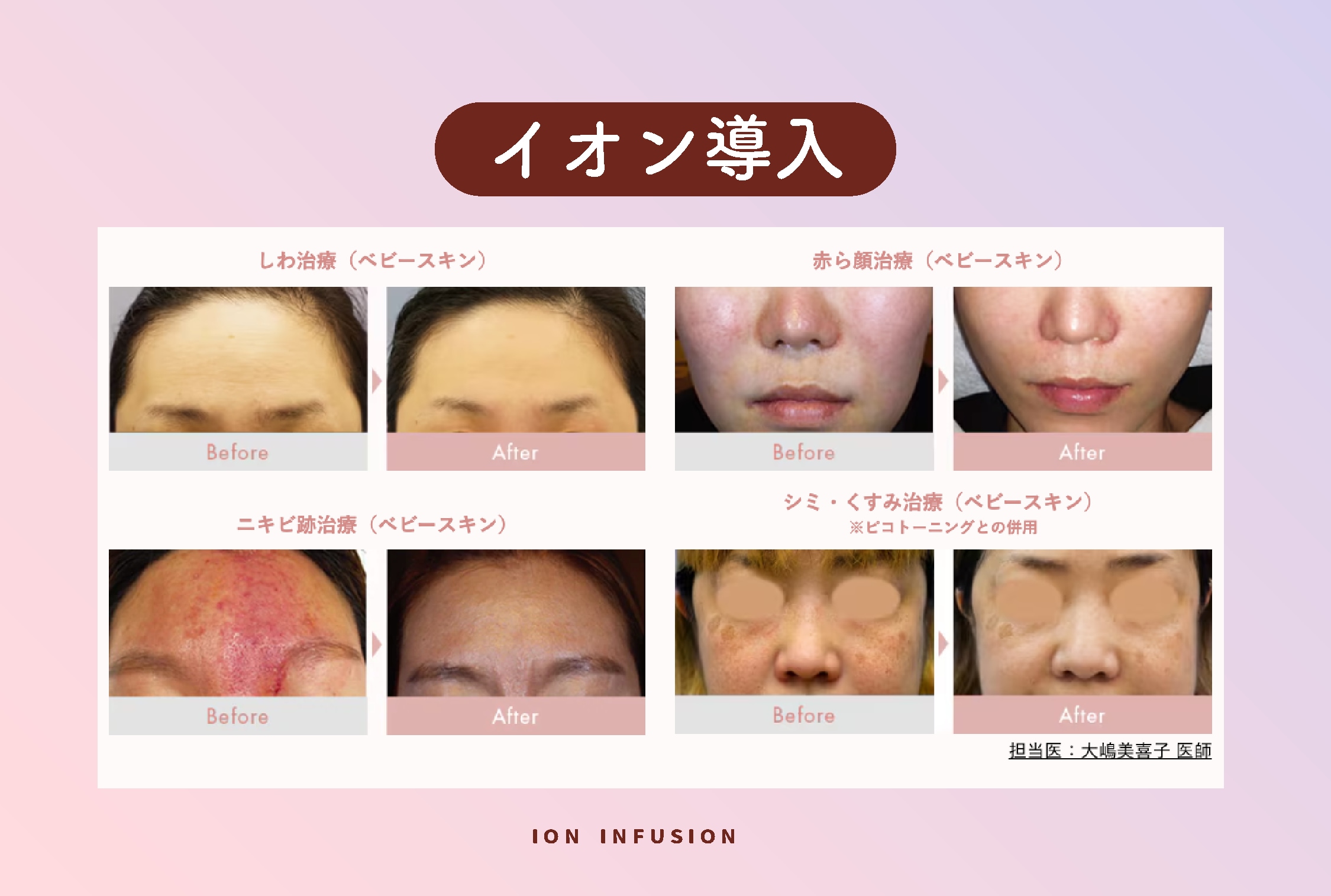 即効性を求めるなら