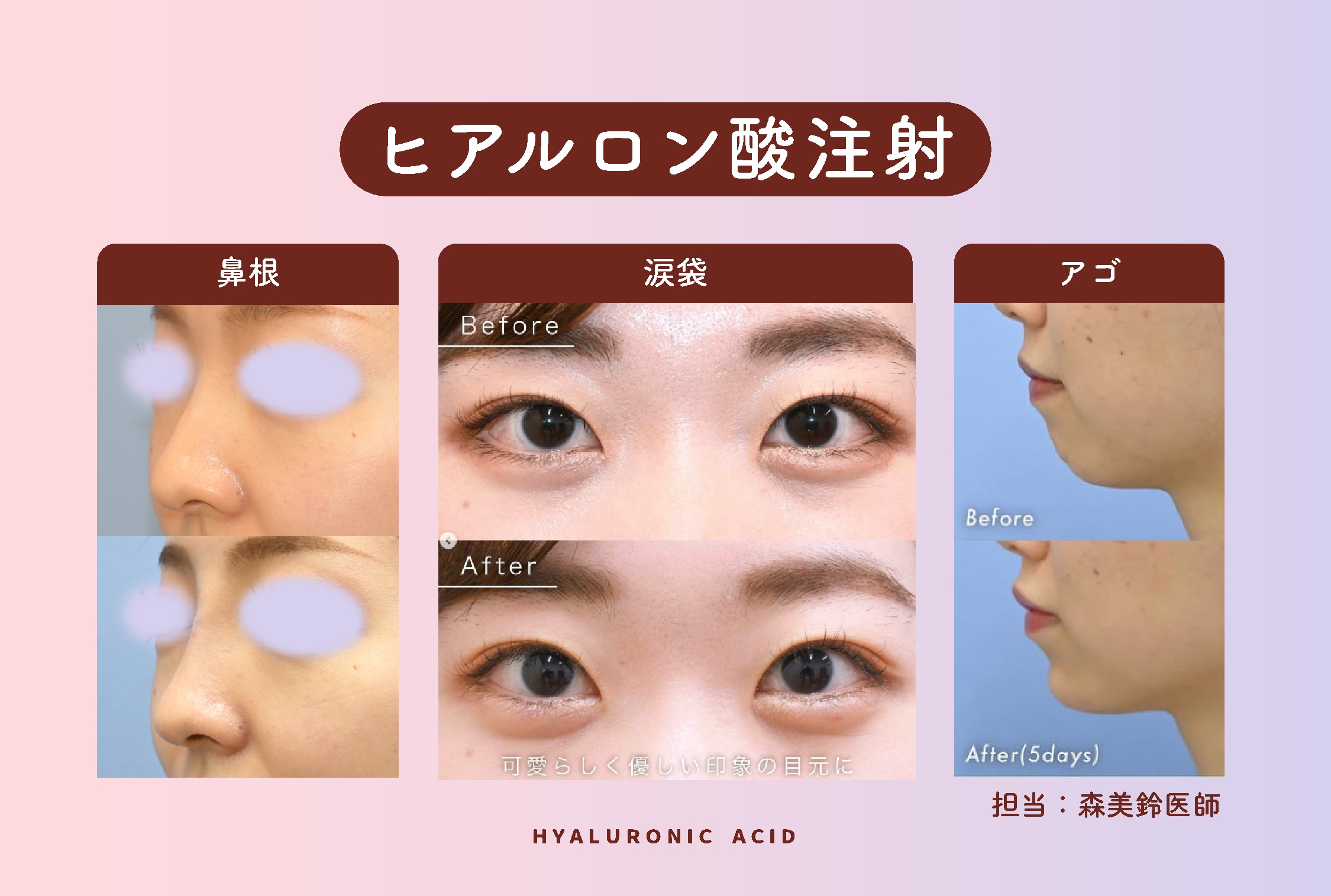 ナチュラルに整う立体感