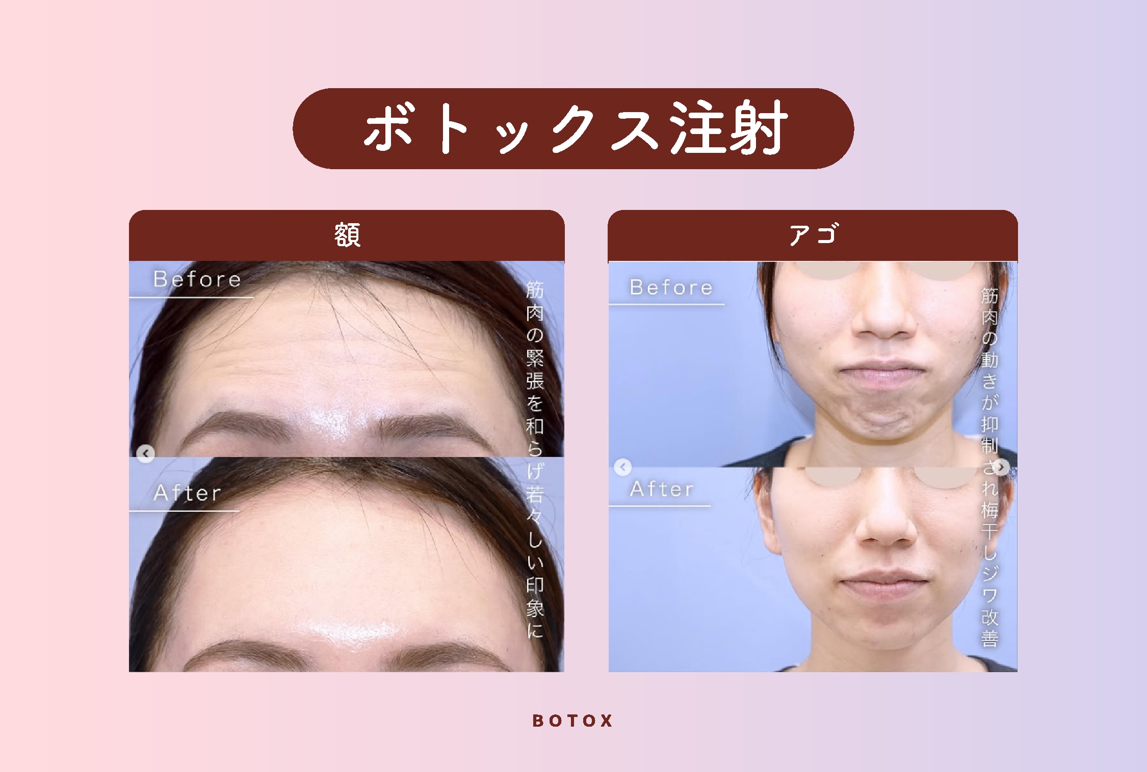 表情はそのまま、すっきり印象へ