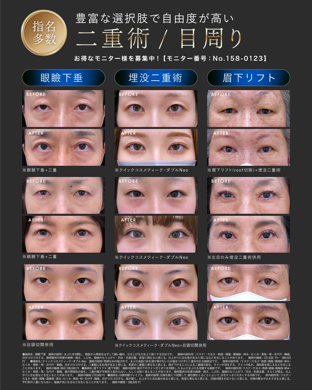 須見院長のナチュラル二重コレクション👀