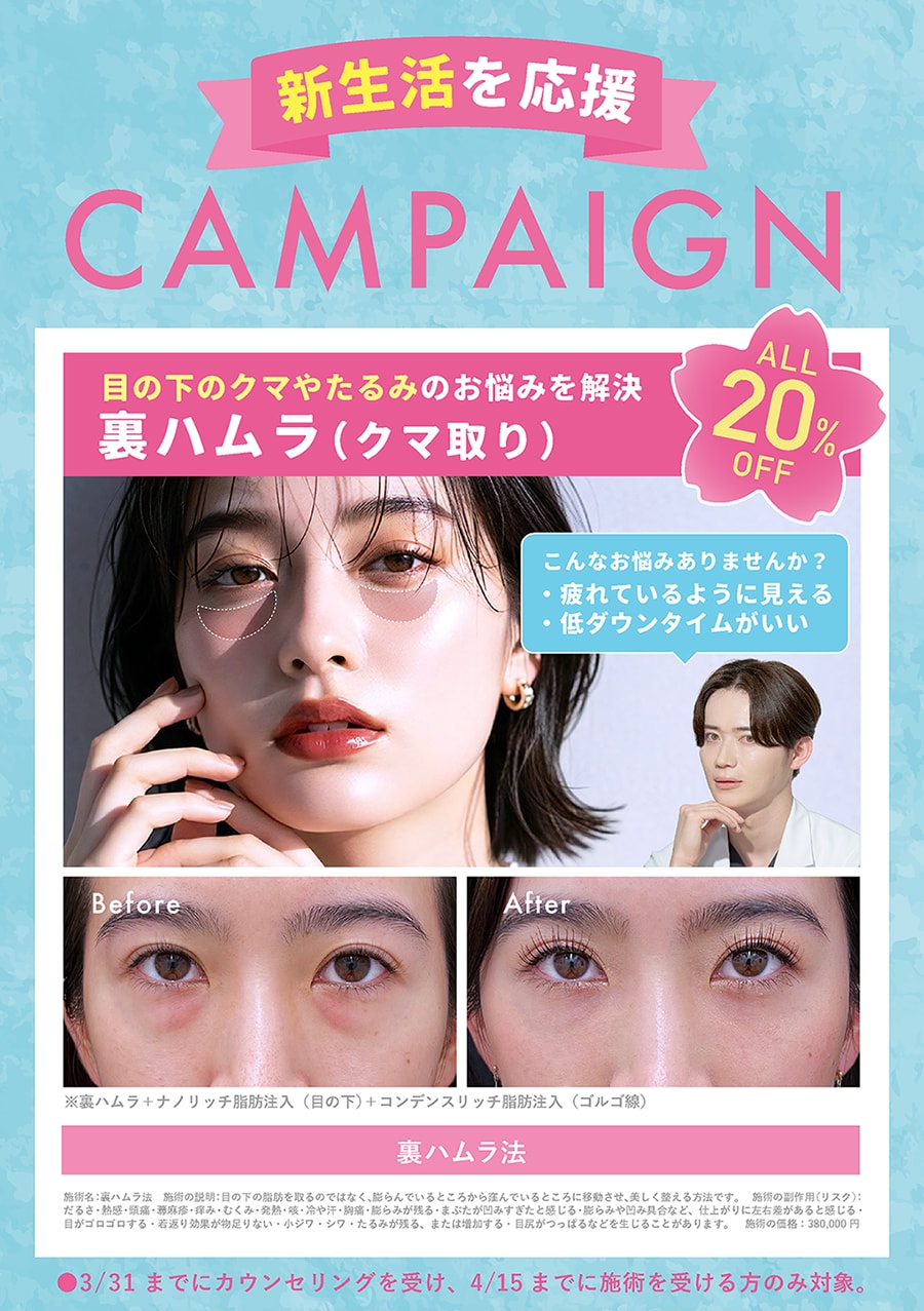 目の下のクマ取り20%OFFキャンペーン