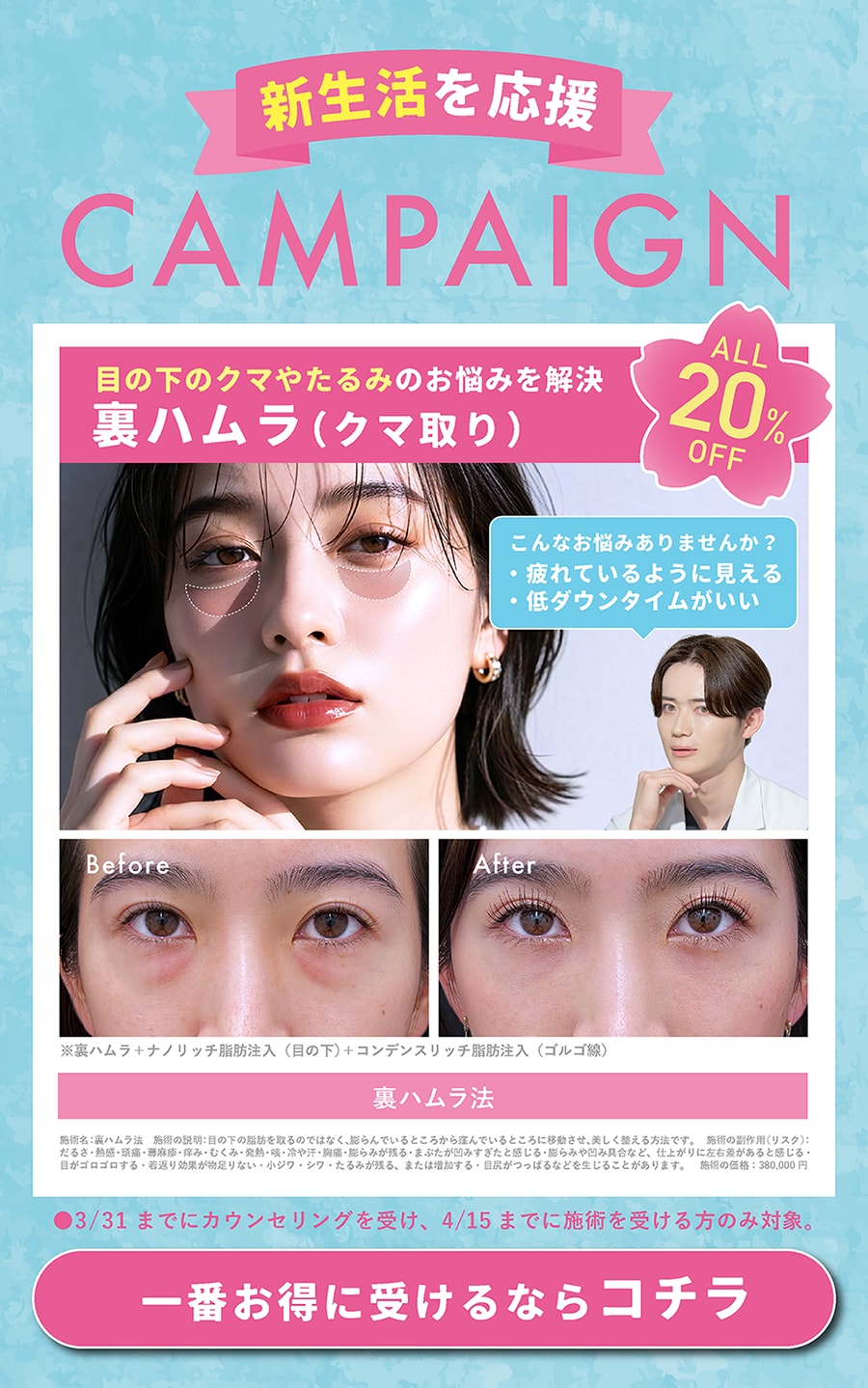 新生活応援キャンペーン🌸クマ取りALL20%オフ✨
