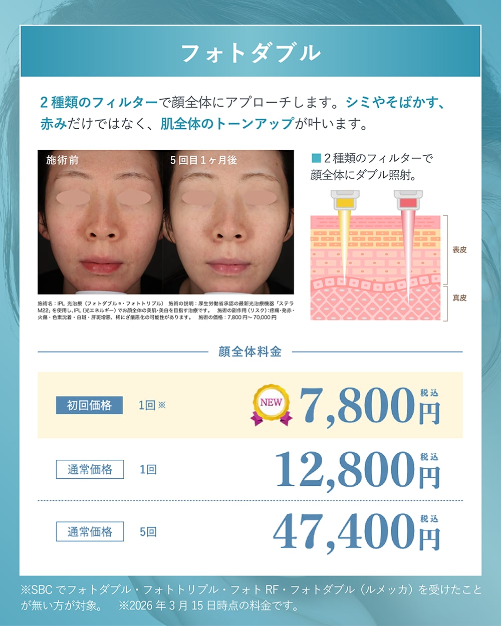 フォトダブル l シミ・赤み・くすみをまとめて改善