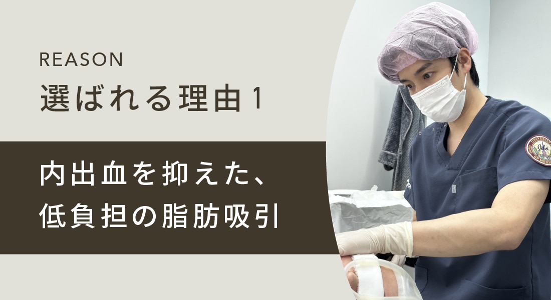 👑内出血を抑えた、低負担の脂肪吸引