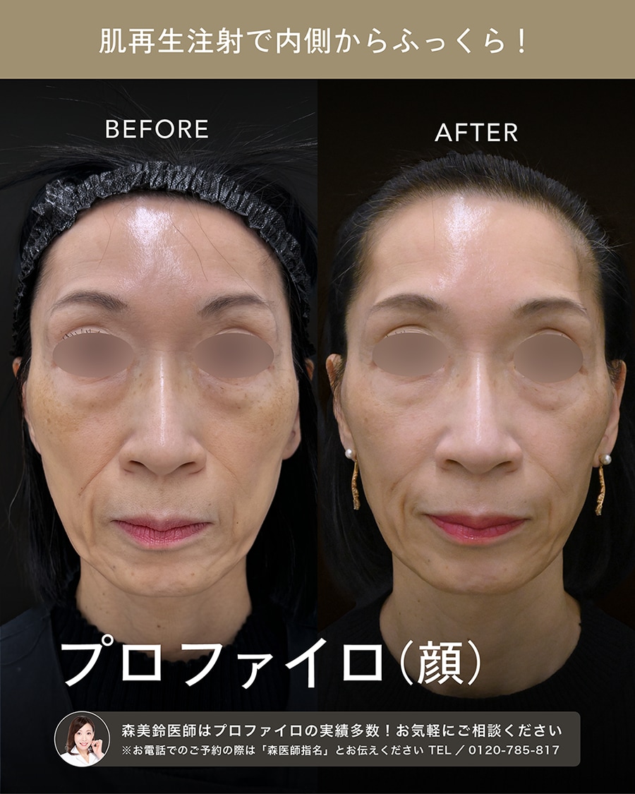 顔のプロファイロもお任せ！