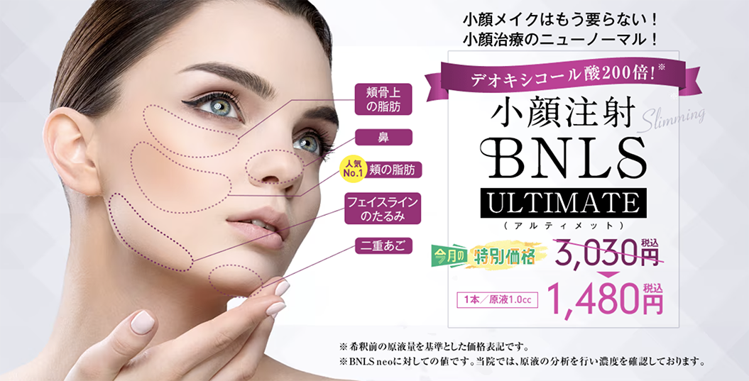 BNLSアルティメット