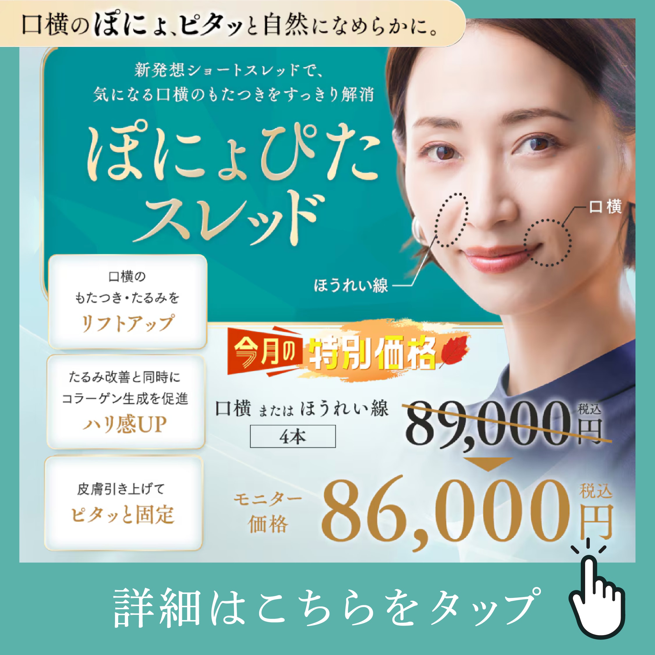 皮膚科【9月新登場】本厚木院に「ぽにょぴたスレッド」導入｜口横のぽにょ・ほうれい線・マリオネットラインに