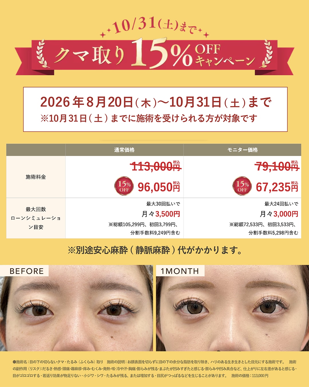 目の下のクマ・ふくらみをすっきりさせたい方へ