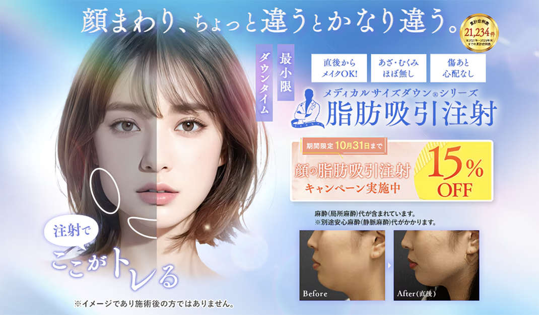 脂肪吸引注射って？