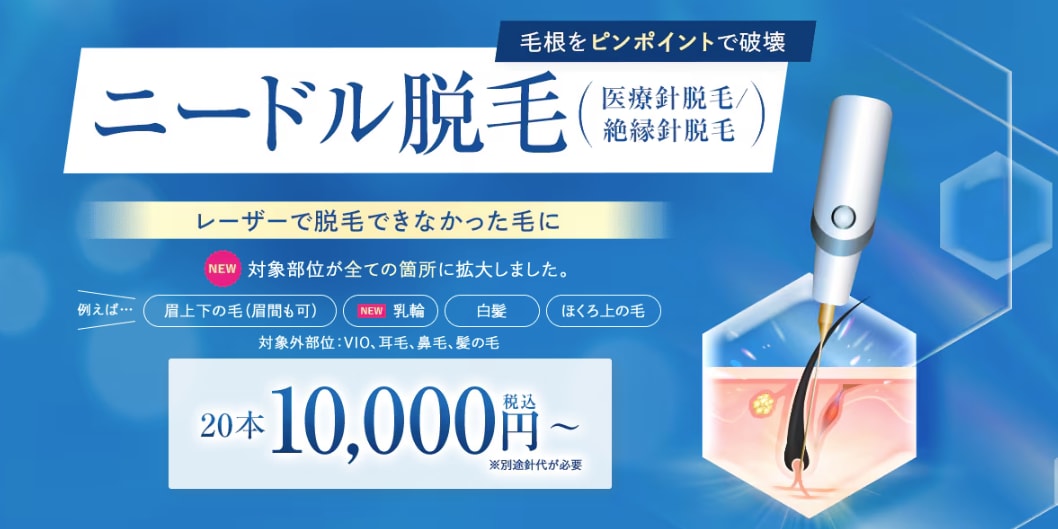 本厚木院でニードル脱毛の取り扱いがスタート