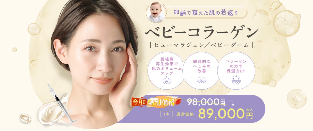 ベビコラ10月CP