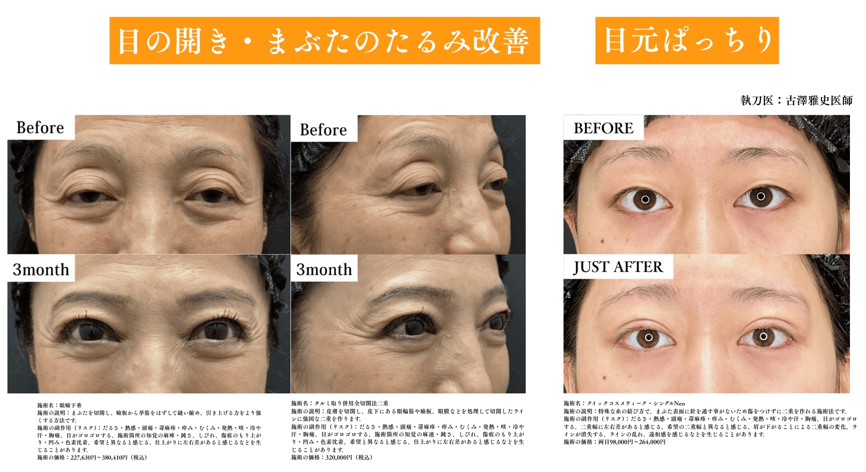 二重施術