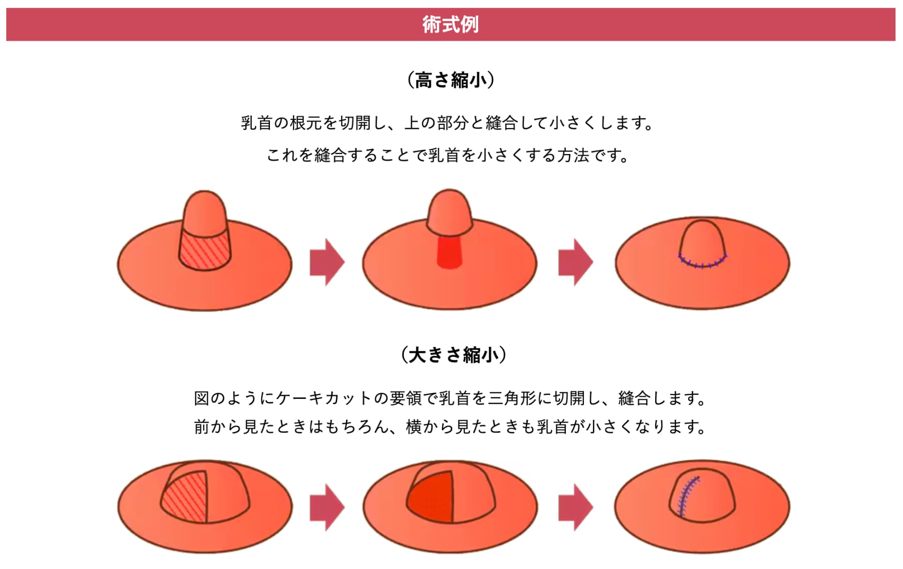 施術方法