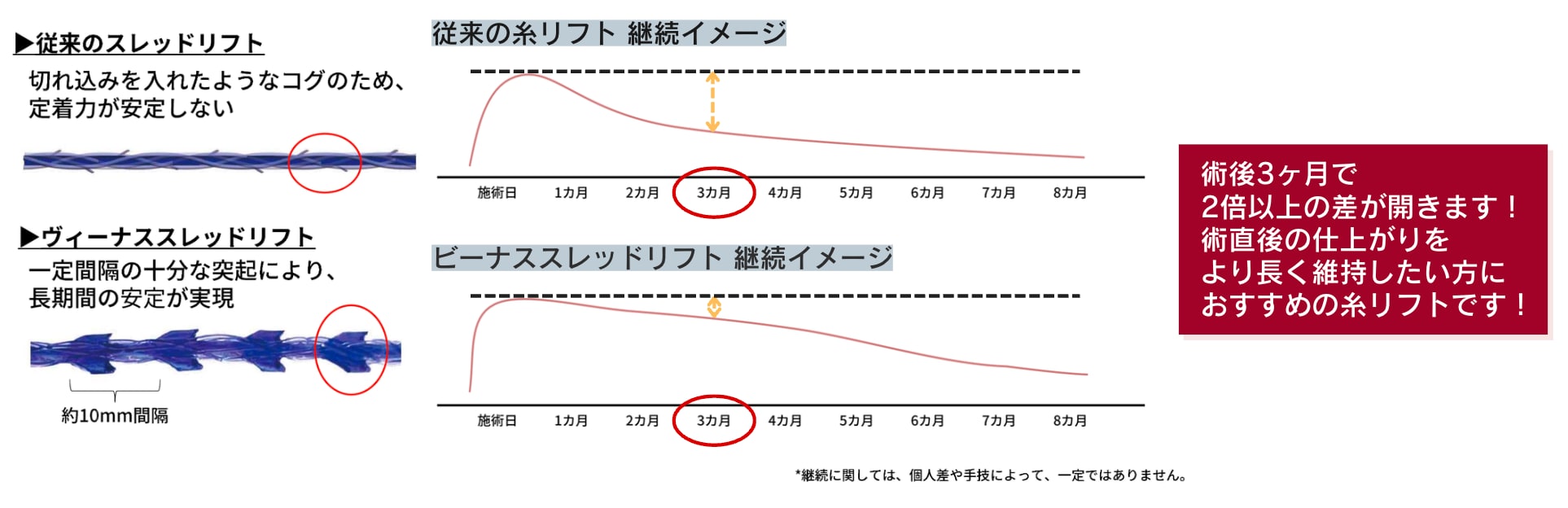 リフティング力や固定力の強化
