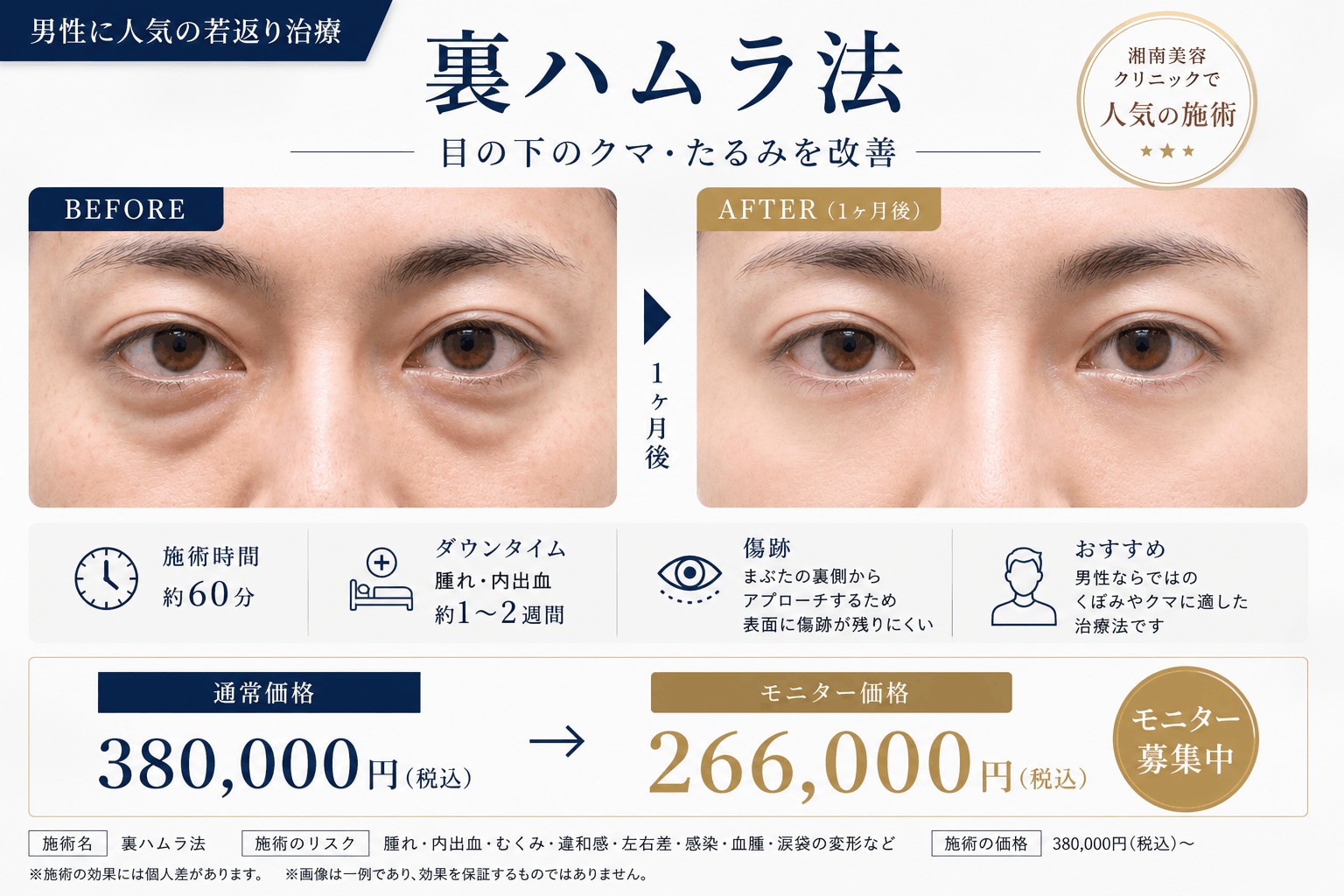 目の下のクマを改善して、若々しい印象へ