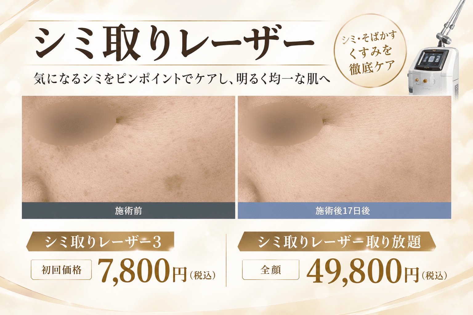 シミ・くすみにお悩みの方へ