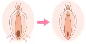膣を引き締めたい