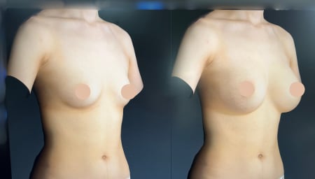 実は鼻だけじゃないんです！