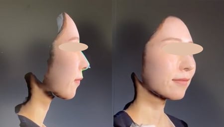 〜最新の3D解析を、医師の確かな技術と黄金比で形にする〜