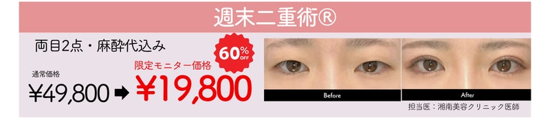 湘南美容クリニック　池袋西口院　4月　キャンペーン　安い　二重　埋没　週末二重　60％OFF