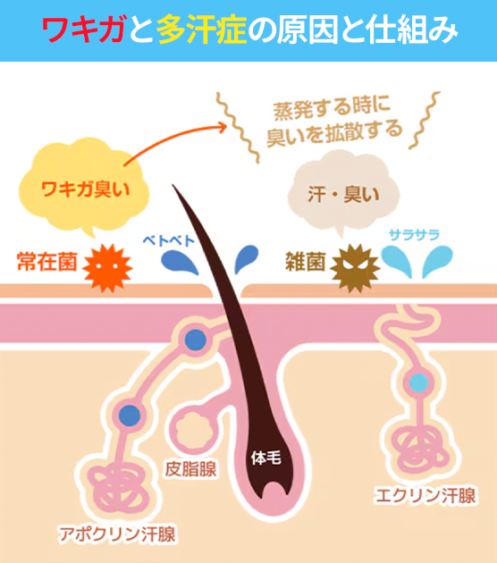 ワキ汗・ワキガの原因と仕組みとは？（エクリン腺・アポクリン腺の違い）