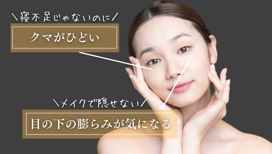 【4/15まで限定🉐】池袋でクマ取りをお得に！新生活応援キャンペーン実施中🔥