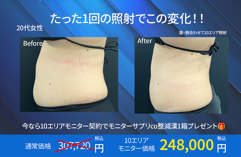 1回の照射の変化の様子