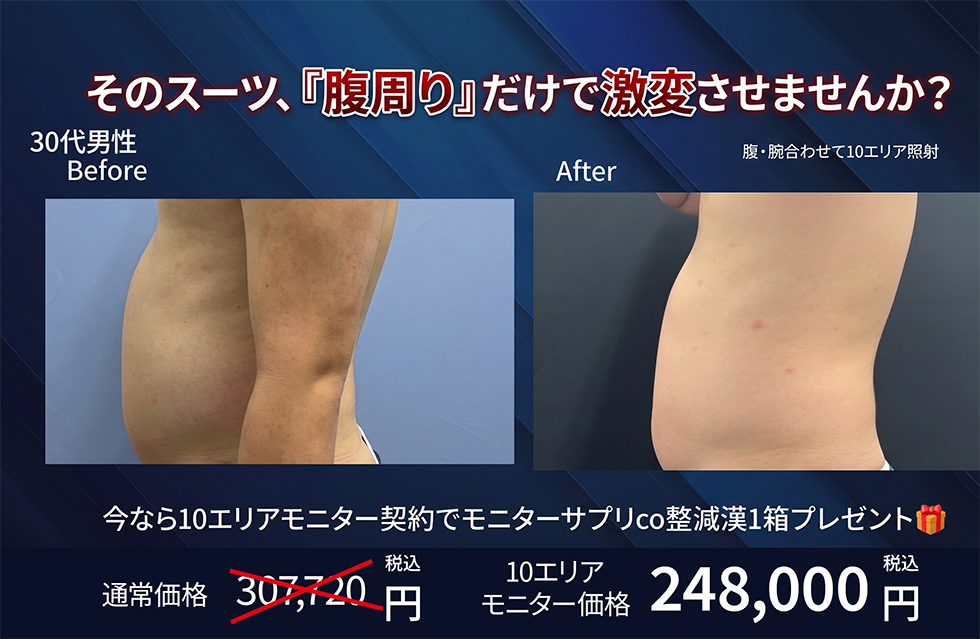 クールスカルプティングはこのような男性におすすめ