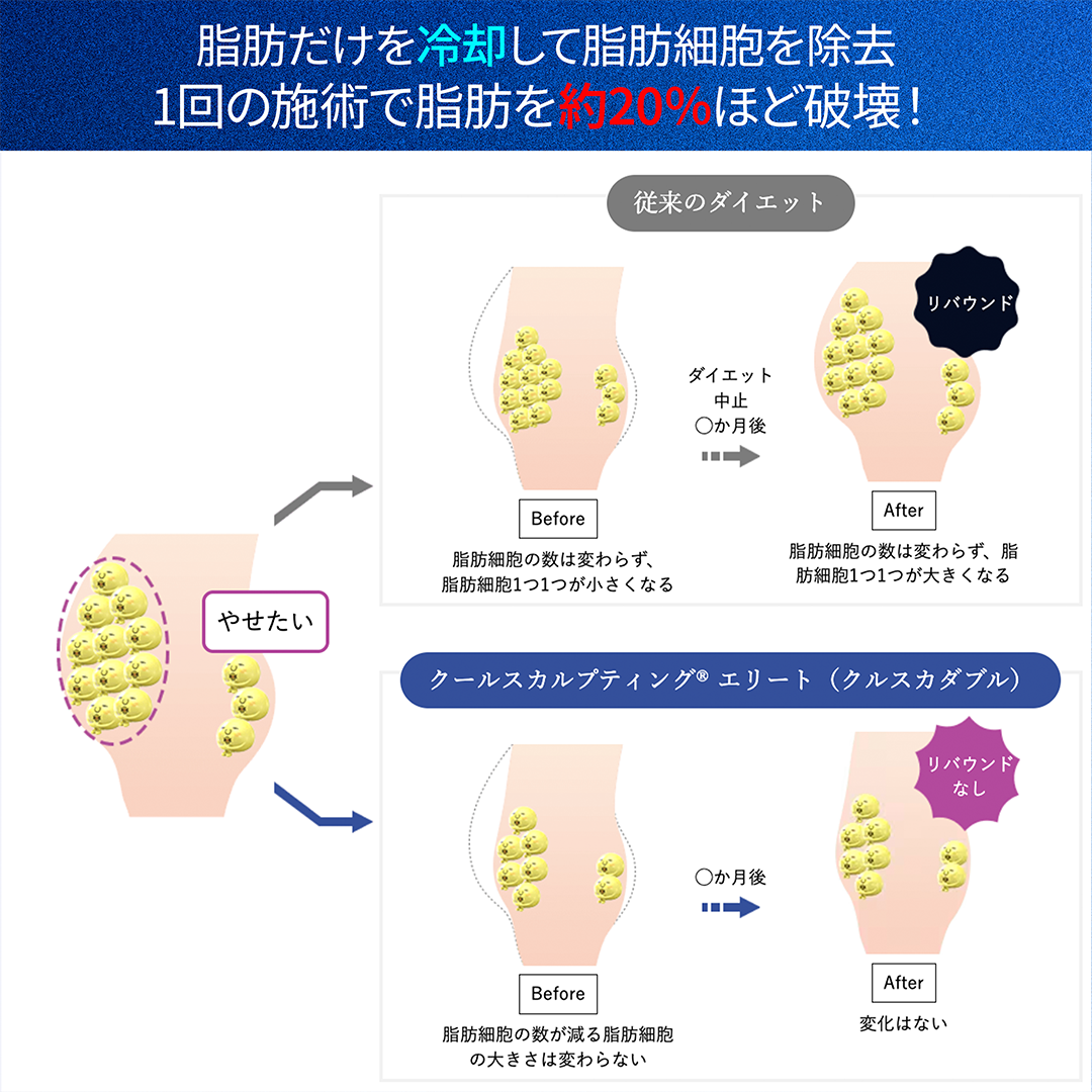 脂肪冷却で脂肪細胞自体の数を減らすから「リバウンド」なし！<br />
<br />
