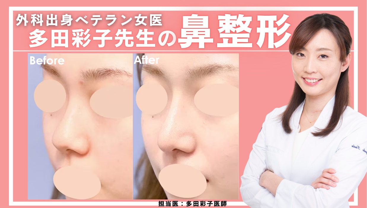 【鼻整形】多田彩子院長が創る、360度どこから見ても美しい横顔