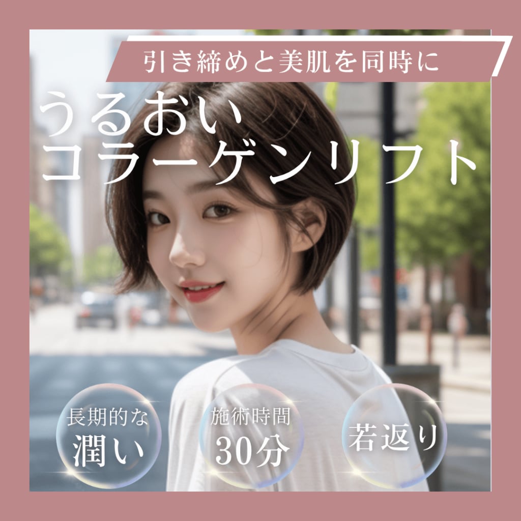 池袋　うるおいコラーゲンリフト　5月キャンペーン　糸リフト　肌質改善