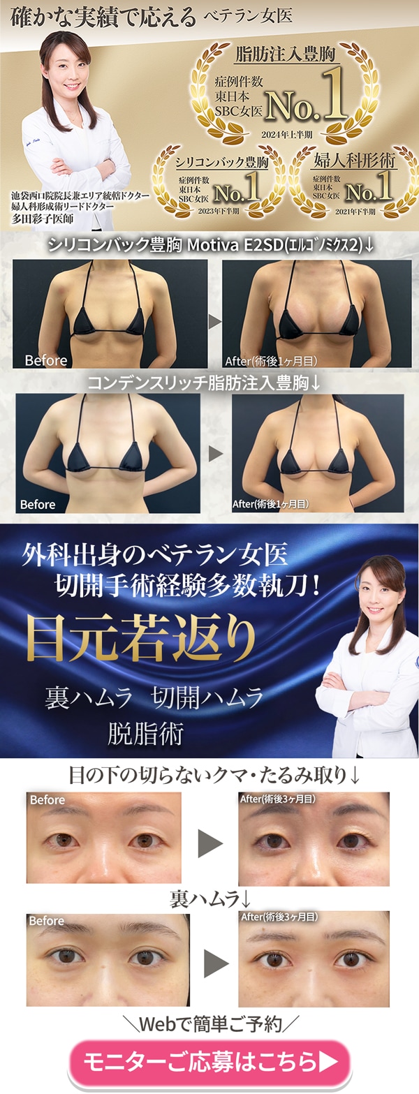 婦人科形成リードドクター多田彩子医師 婦人科形成・美バスト豊胸特集