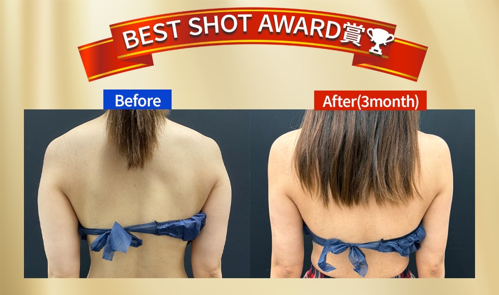 BEST SHOT AWARD賞受賞👑