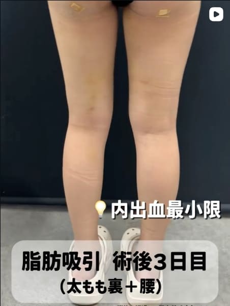 Instagram投稿1