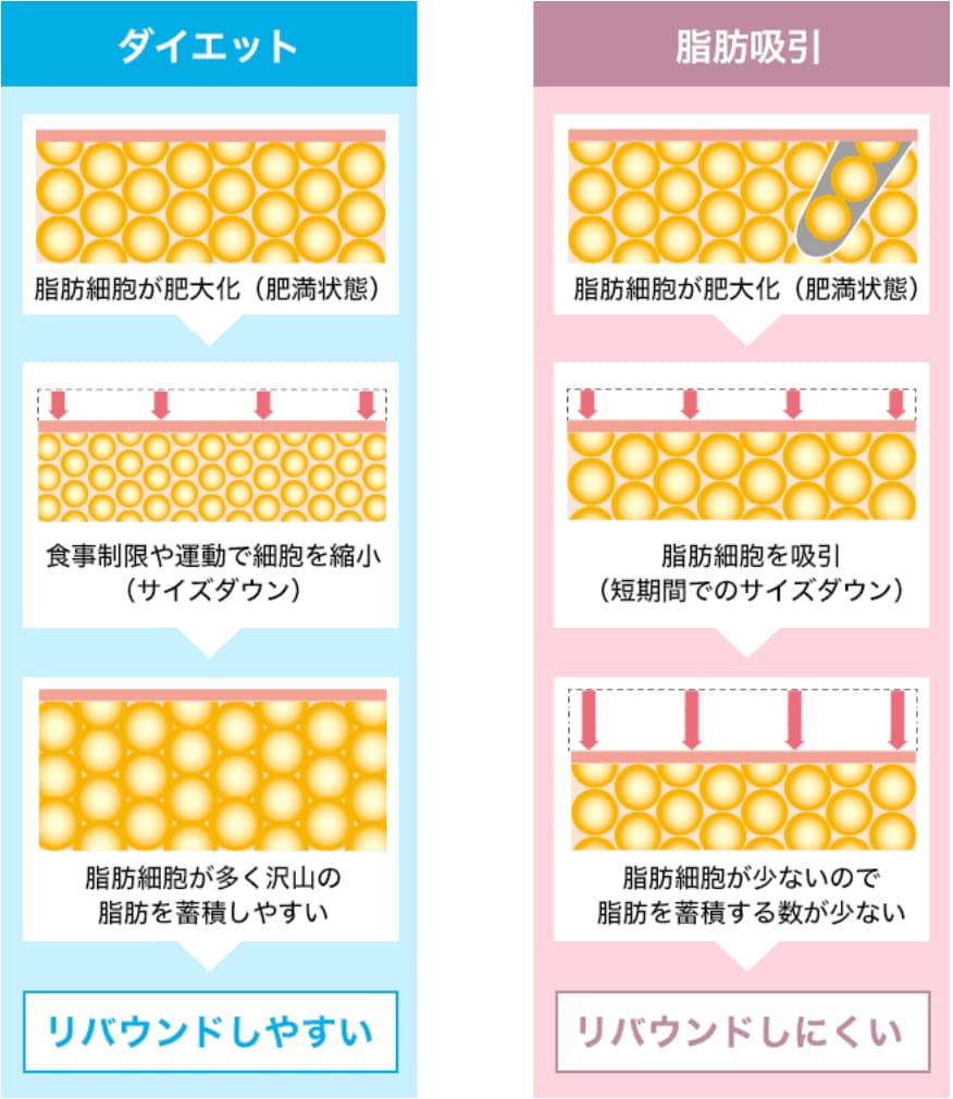 脂肪吸引でリバウンドしづらい仕組み