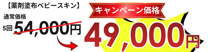 キャンペーン価格　安い　お得　池袋