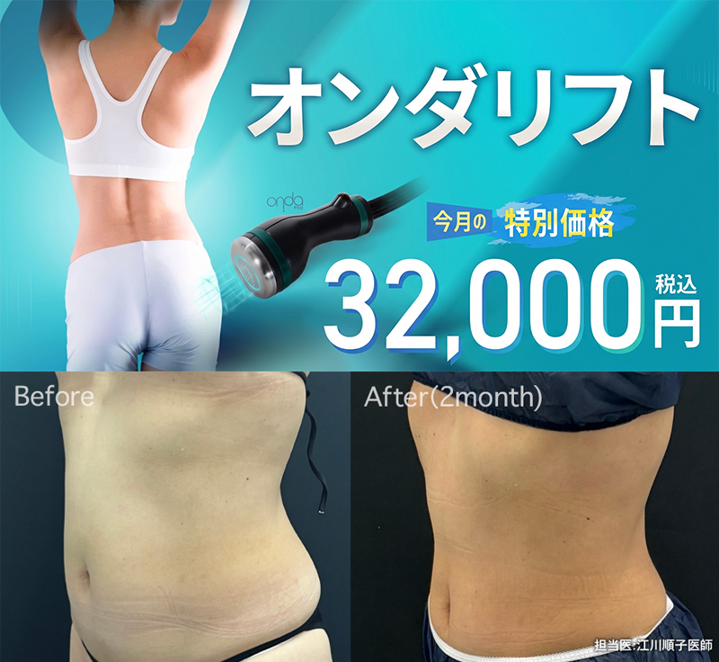 オンダ新着