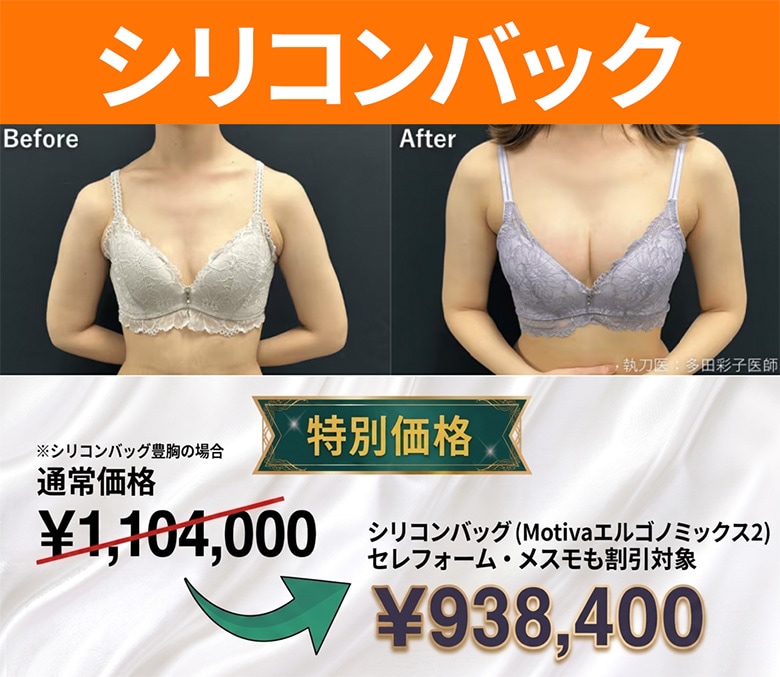 シリコンバック金額